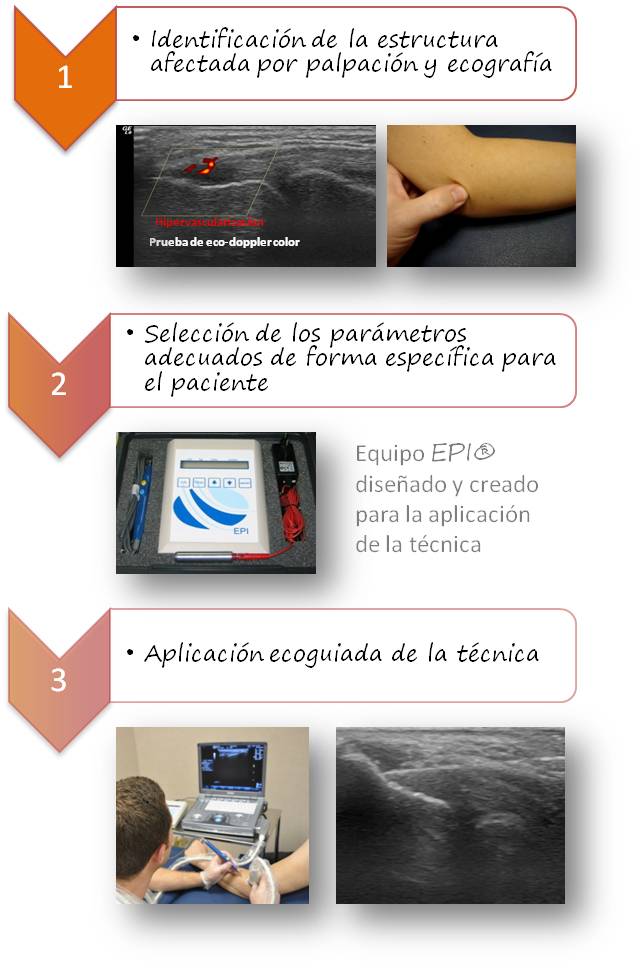 Preguntas frecuentes sobre el tratamiento de ultrasonido para  rehabilitación - Abilita