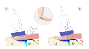 Figure 3_high