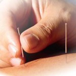 La acupuntura es una terapia eficaz y reduce el coste sanitario